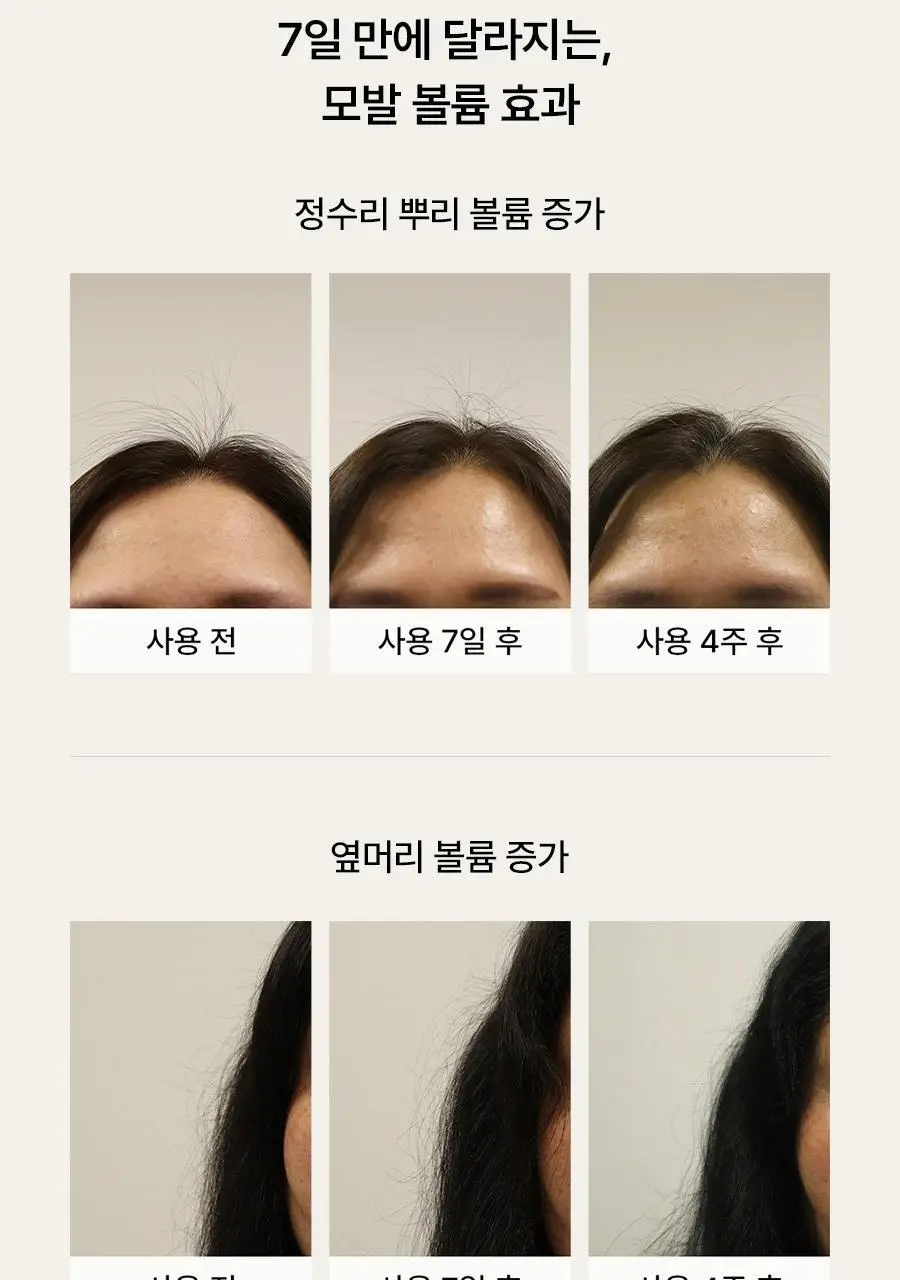 [4주완성탈모앰플/두피진정보습] 아로마티카 로즈마리 루트 볼류마이징 두피 앰플 20ml (단품/세트) 상세페이지 10